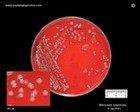 Moraxella catarrhalis in Petri dish